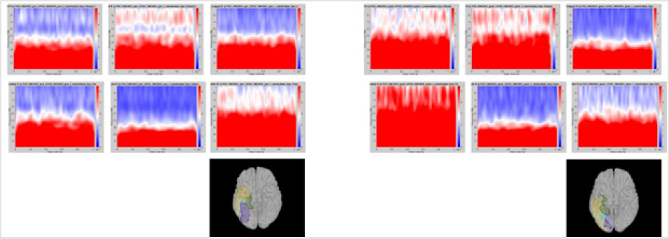 biomedres-openaccess-journal-bjstr