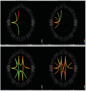 biomedres-openaccess-journal-bjstr