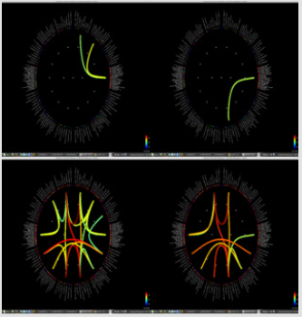 biomedres-openaccess-journal-bjstr