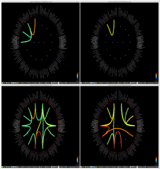 biomedres-openaccess-journal-bjstr