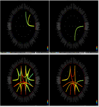 biomedres-openaccess-journal-bjstr