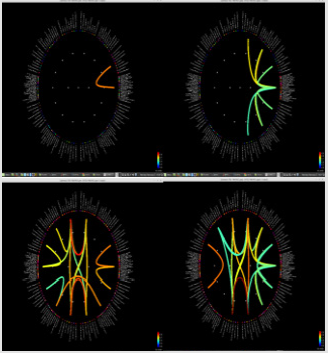 biomedres-openaccess-journal-bjstr