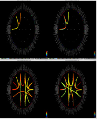 biomedres-openaccess-journal-bjstr