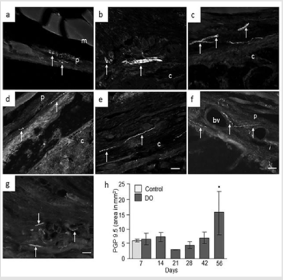 biomedres-openaccess-journal-bjstr