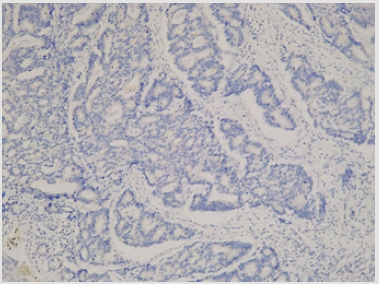 biomedres-openaccess-journal-bjstr