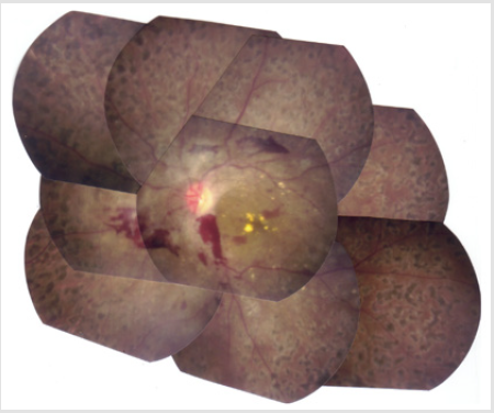 biomedres-openaccess-journal-bjstr