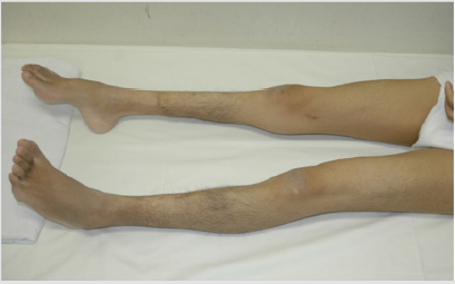 biomedres-openaccess-journal-bjstr