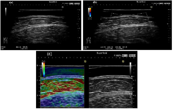 biomedres-openaccess-journal-bjstr