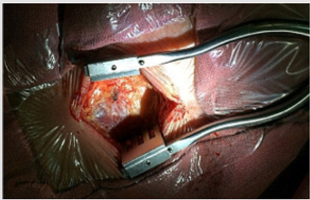 biomedres-openaccess-journal-bjstr