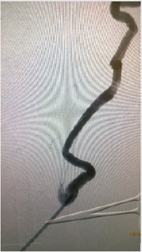 biomedres-openaccess-journal-bjstr