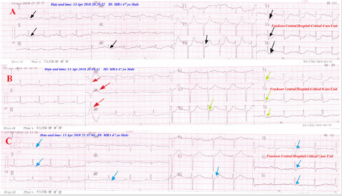 biomedres-openaccess-journal-bjstr