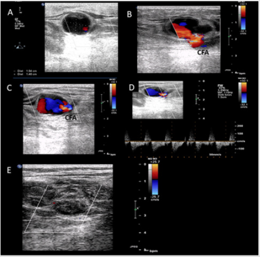 biomedres-openaccess-journal-bjstr