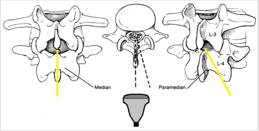 biomedres-openaccess-journal-bjstr