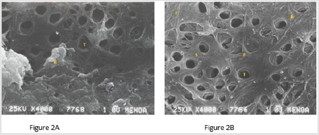 biomedres-openaccess-journal-bjstr