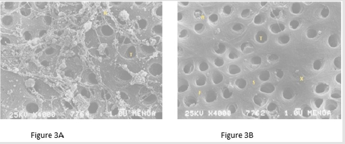 biomedres-openaccess-journal-bjstr