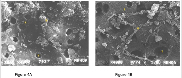 biomedres-openaccess-journal-bjstr