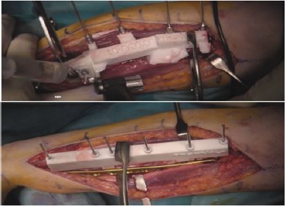 biomedres-openaccess-journal-bjstr