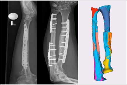 biomedres-openaccess-journal-bjstr