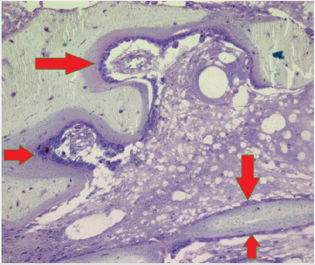 biomedres-openaccess-journal-bjstr