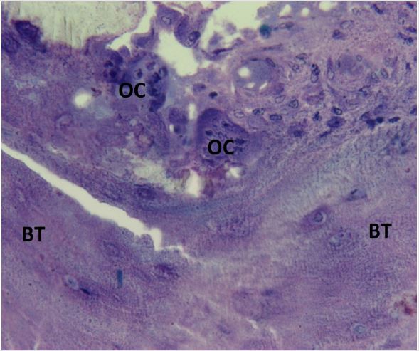 biomedres-openaccess-journal-bjstr