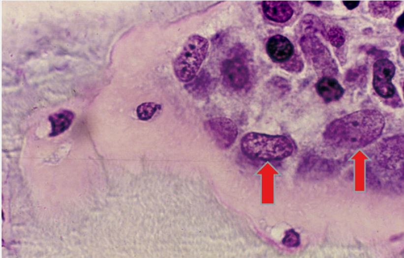 biomedres-openaccess-journal-bjstr