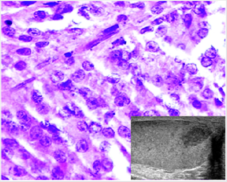 biomedres-openaccess-journal-bjstr