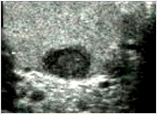 biomedres-openaccess-journal-bjstr