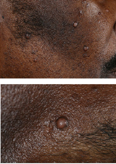 biomedres-openaccess-journal-bjstr