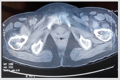 biomedres-openaccess-journal-bjstr