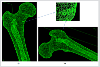 biomedres-openaccess-journal-bjstr