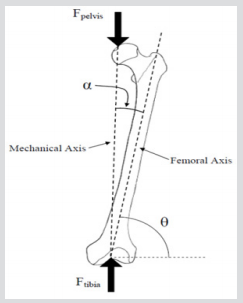 biomedres-openaccess-journal-bjstr