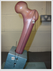 biomedres-openaccess-journal-bjstr