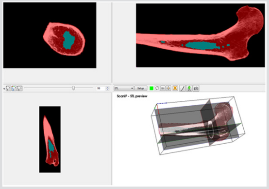 biomedres-openaccess-journal-bjstr