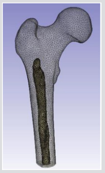 biomedres-openaccess-journal-bjstr