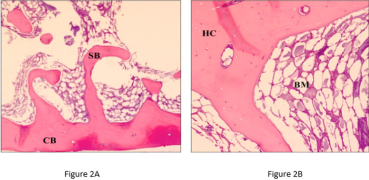 biomedres-openaccess-journal-bjstr