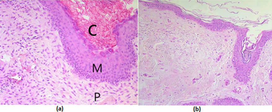 biomedres-openaccess-journal-bjstr