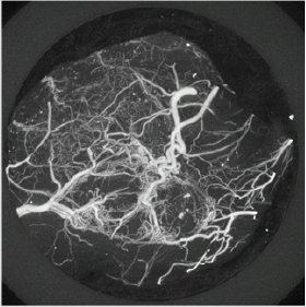 biomedres-openaccess-journal-bjstr
