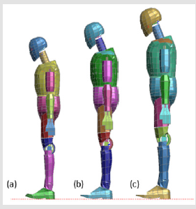 biomedres-openaccess-journal-bjstr