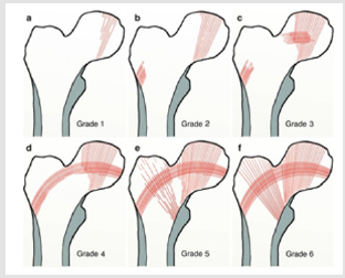 biomedres-openaccess-journal-bjstr