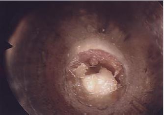 biomedres-openaccess-journal-bjstr