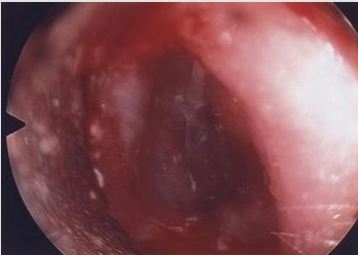 biomedres-openaccess-journal-bjstr