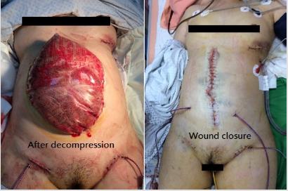 biomedres-openaccess-journal-bjstr