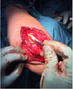 biomedres-openaccess-journal-bjstr