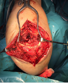 biomedres-openaccess-journal-bjstr