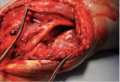 biomedres-openaccess-journal-bjstr