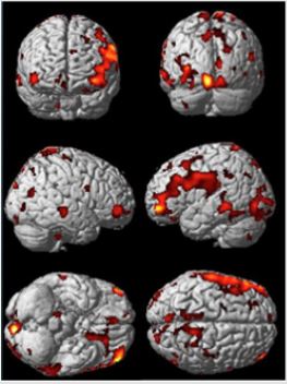 biomedres-openaccess-journal-bjstr