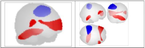 biomedres-openaccess-journal-bjstr