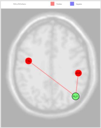 biomedres-openaccess-journal-bjstr