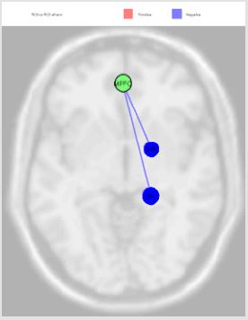 biomedres-openaccess-journal-bjstr