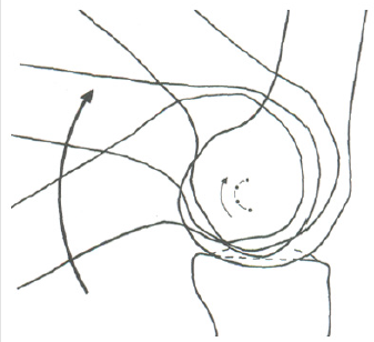 biomedres-openaccess-journal-bjstr